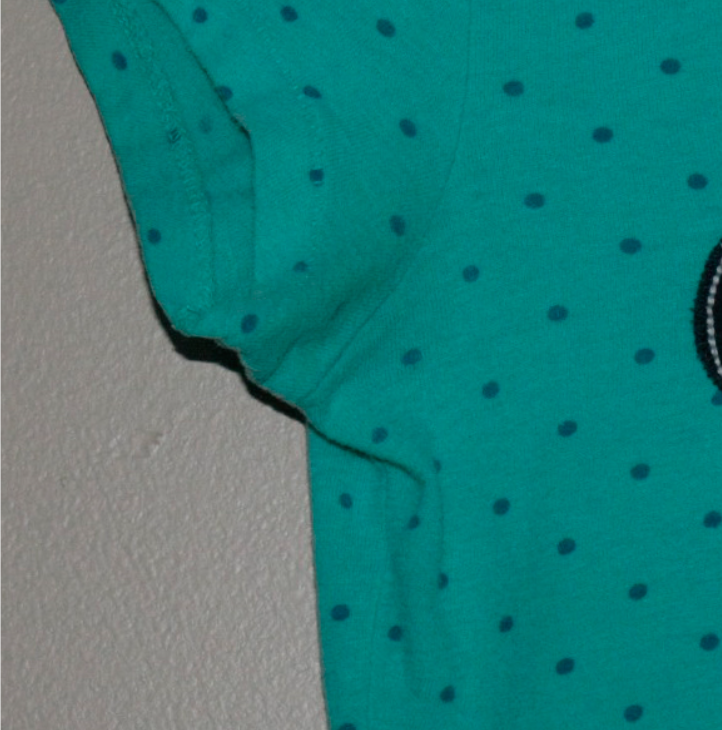 Deodorant Build-up Stains